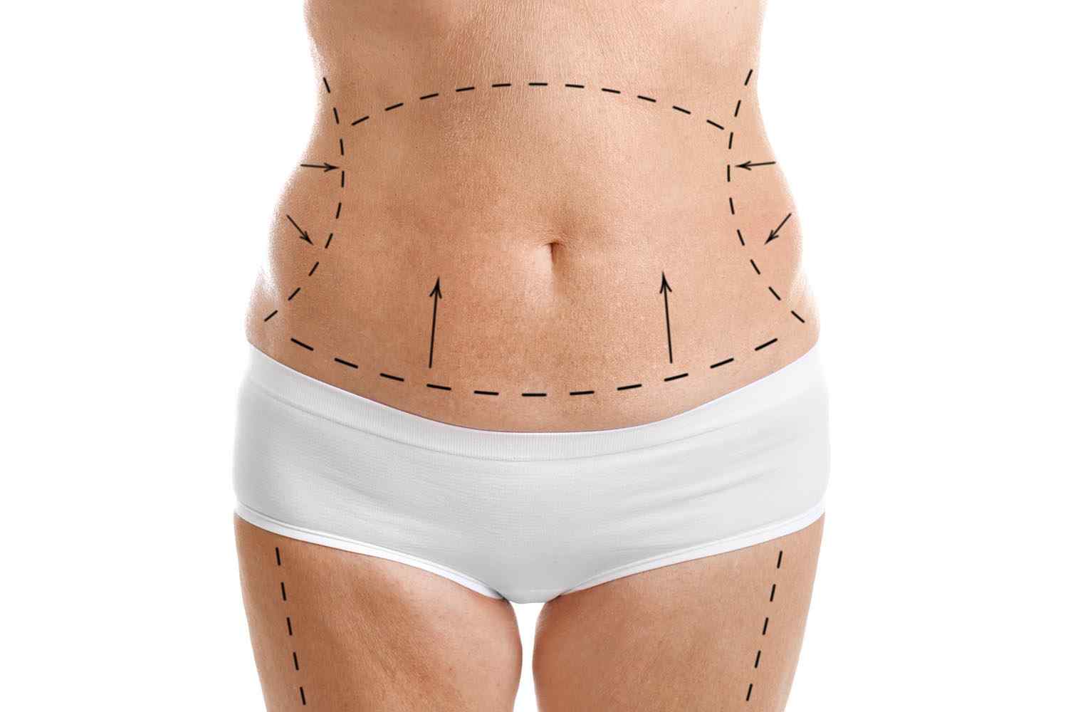 cosmetic-surgery-blog-05.jpg