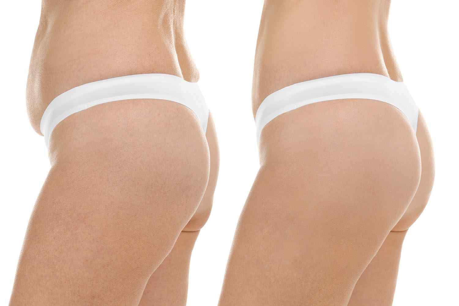 cosmetic-surgery-blog-18.jpg